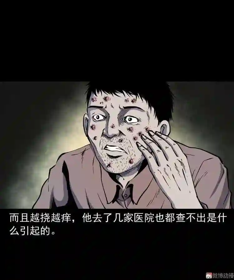 误诊4