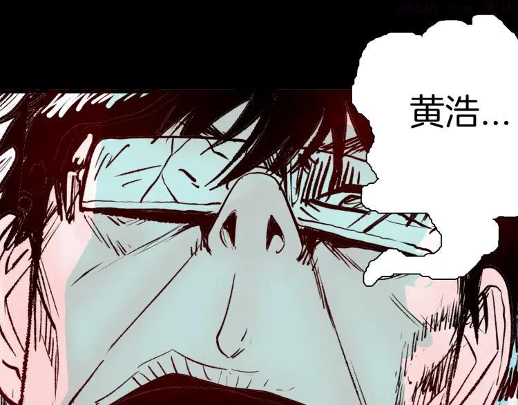 第64话 骨头溶解症（下）4