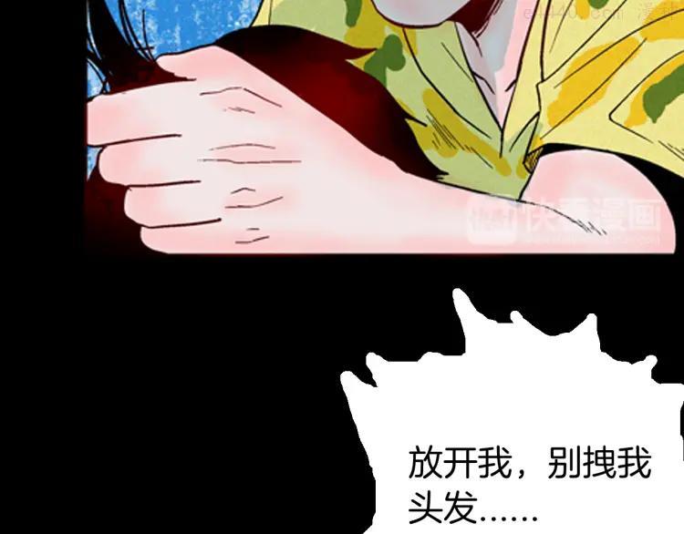 第63话 骨头溶解症（上）1