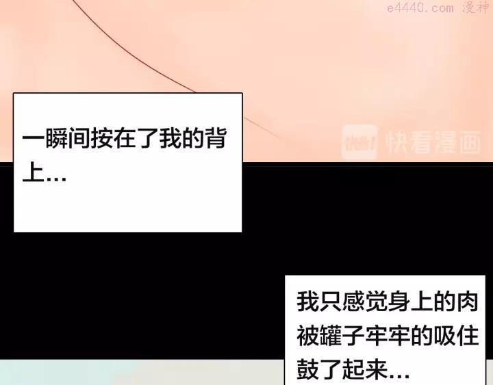 第113话 拔罐1