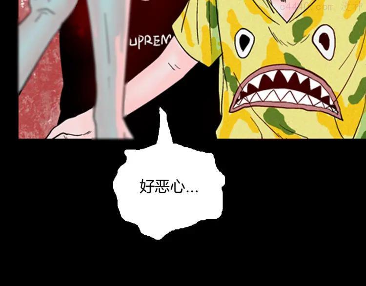 第63话 骨头溶解症（上）0