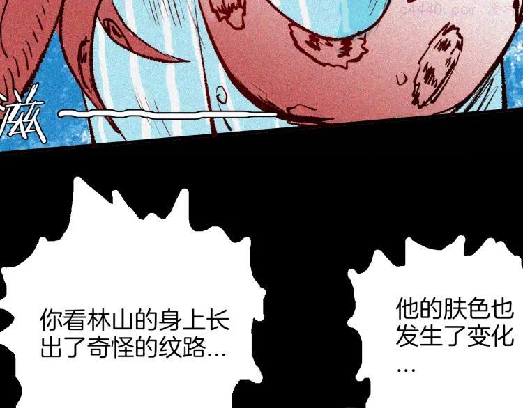 第64话 骨头溶解症（下）0