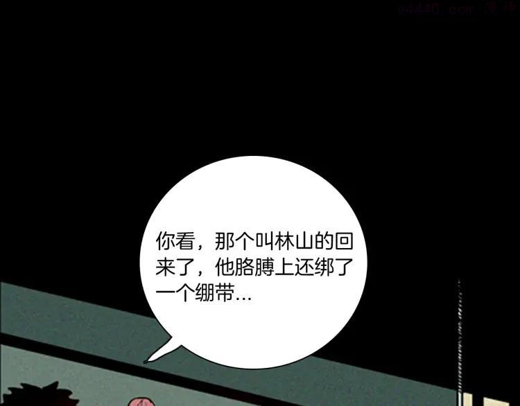 第63话 骨头溶解症（上）2