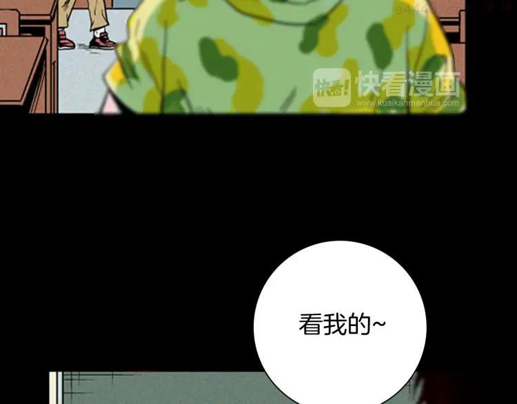 第63话 骨头溶解症（上）3