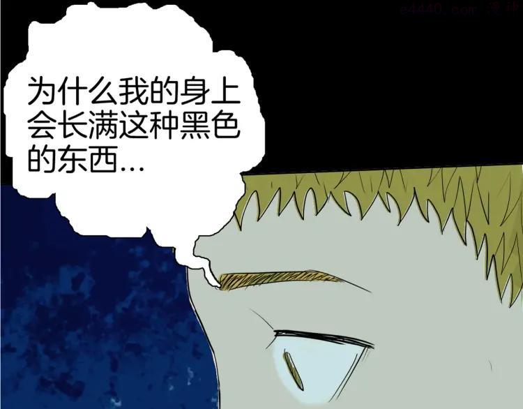 第44话 痣0